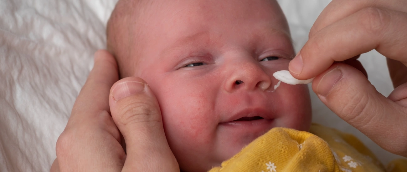 Bebeklerde Burun Tıkanıklığı Belirtileri Nelerdir?