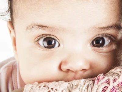 Bebeklerde Çapak Neden Olur? Nasıl Temizlenir